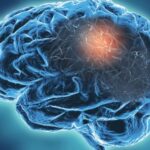 Neurological disorders