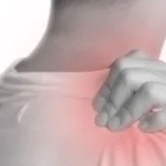 Thoracic Outlet Syndrome